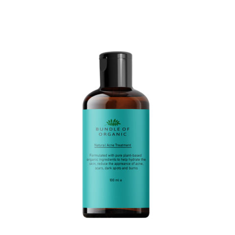 Natural Acne Treatment 100 ml