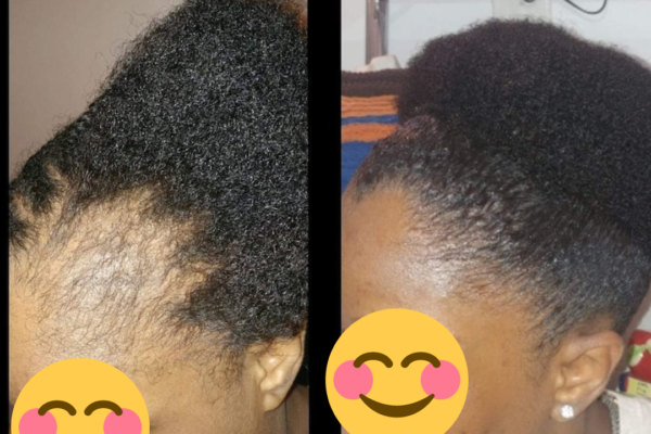 hair hair