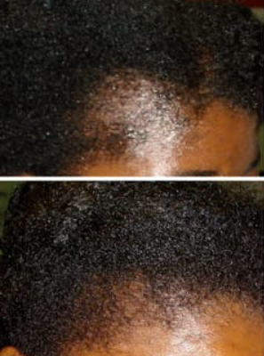 hair hair